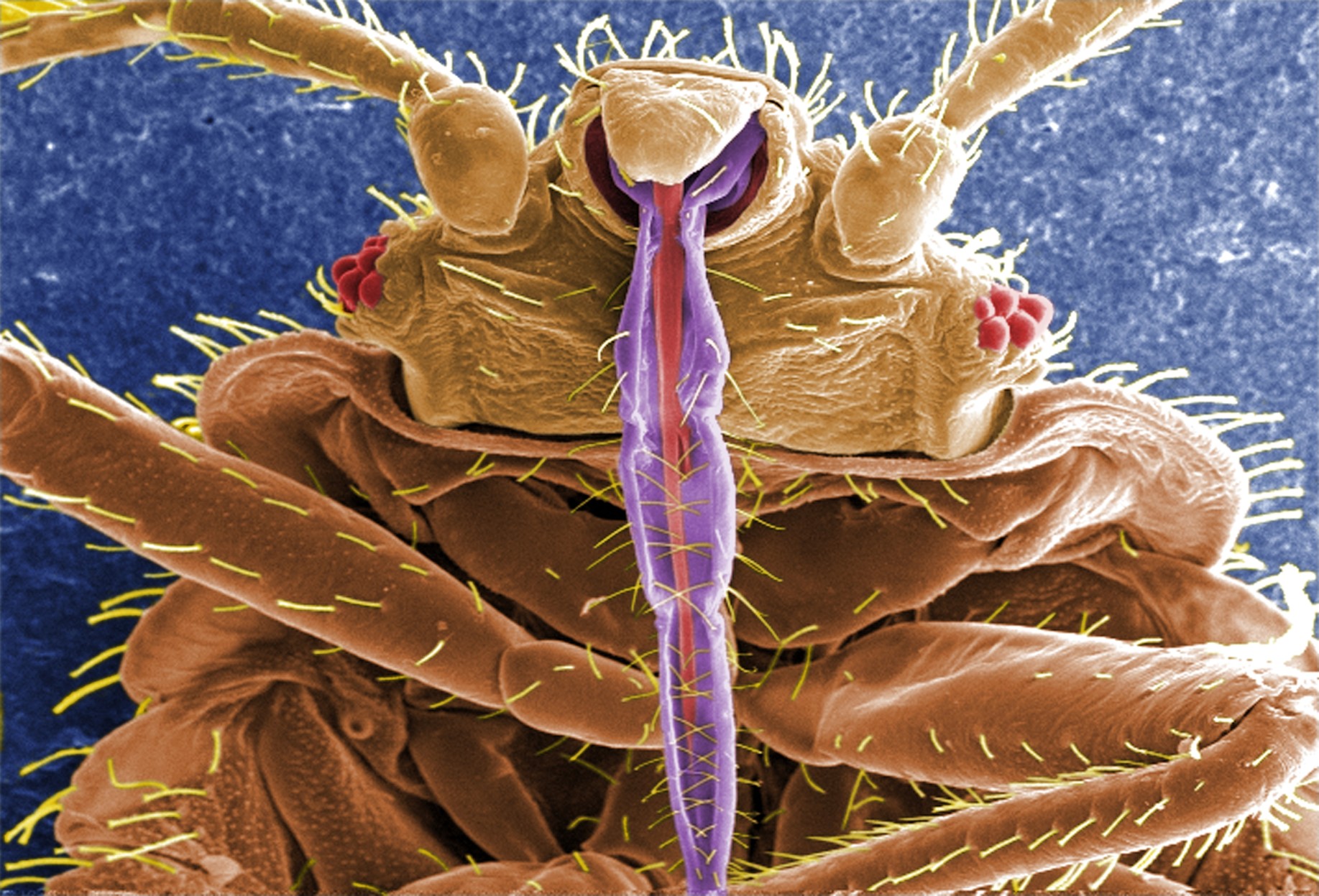 Image courtesy Centers for Disease Control and Prevention